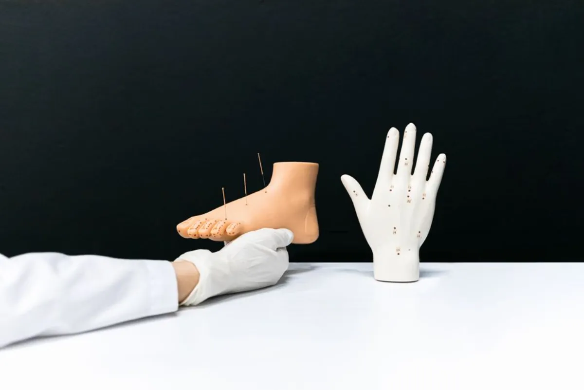 acupuncture meridians